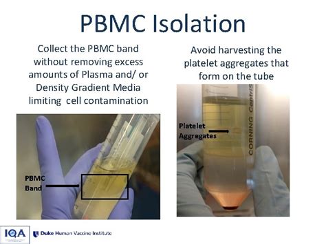 Best Practices For Pbmc Processing From Leukapheresis Products