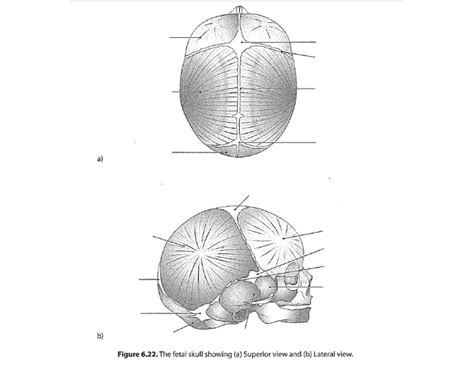 Fetal Skull Sutures and Fontanelles Quiz