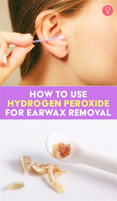 Using hydrogen peroxide for earwax removal safe or not – Artofit