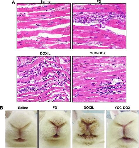 Side Effects In Vx2 Induced Hcc Rabbit Models A Cardiac Toxicities