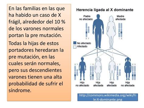 Sindrome Del X Fragil Por Glenda Tuquerres