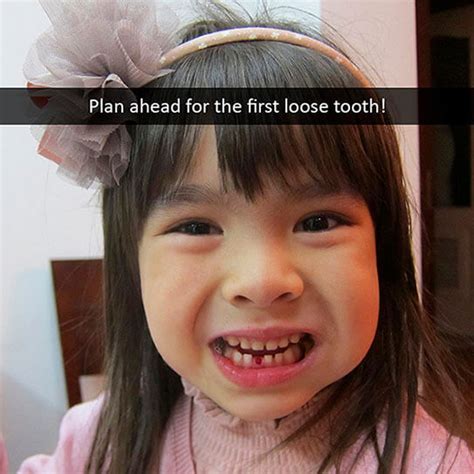 Plan Ahead For The First Loose Tooth Bristol Park Dental