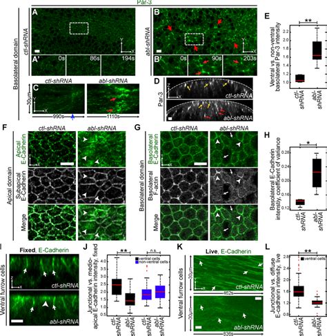 Abl Depletion Disrupts Apical Basal Polarity In Ventral Cells A D