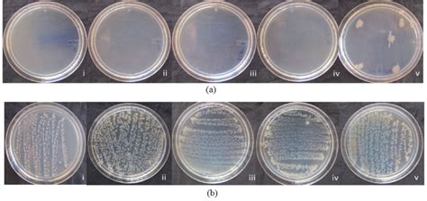 Nutrient Agar Plates Showing Bacterial Count At Different Time Interval