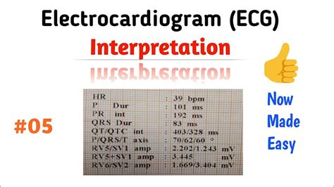 How To Read An Ecg Interpretation 05 Pr Interval Youtube