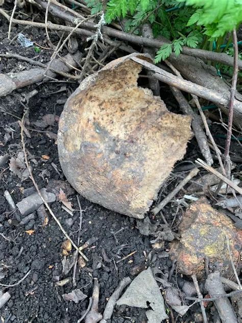 Human Skulls And Bones Being Dug Up From Graveyard And It Is Horrific