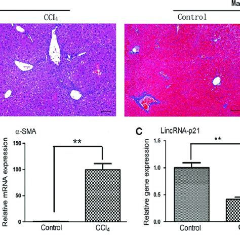 Relative Lincrna P21 Expression In A Ccl 4 Induced Mouse Liver Fibrosis Download Scientific