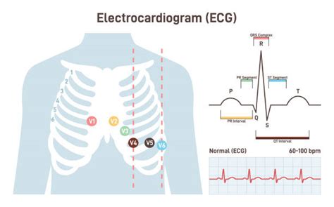 190 Ekg Leads Stock Photos Pictures And Royalty Free Images Istock