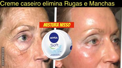 CREME CASEIRO ELIMINA RUGAS E MANCHAS DA PELE USANDO CREME NIVEA YouTube