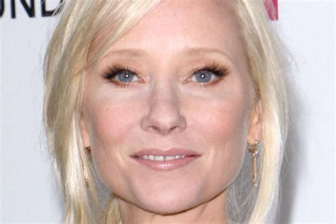 Anne Heche Reportedly In Critical Condition Following La Vehicle Collision