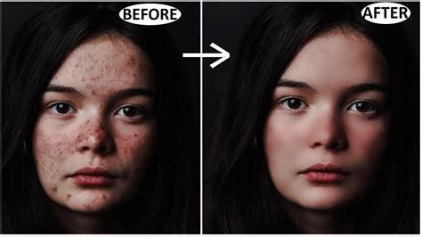 Skin Retouching Photoshop Cc Piximperfect Youtube