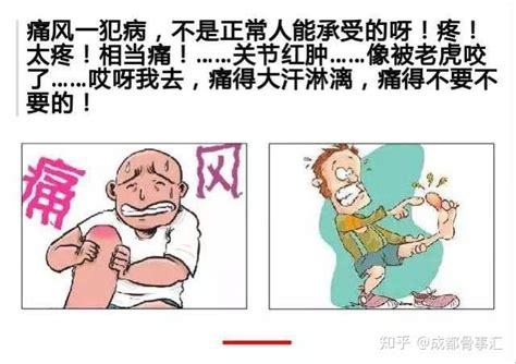 痛风竟有间歇期？痛风四大时期典型症状，你是第几期 知乎