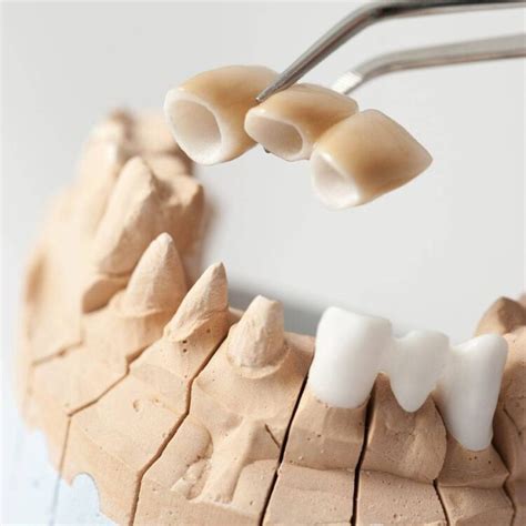 Zirconium Crowns Hsmile Dental Clinic Turkey Dental