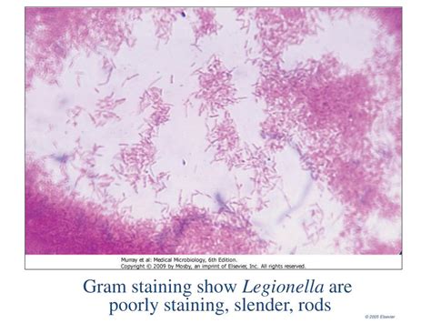 PPT - Haemophilus , Legionella and Bordetella Gram Negative Rods of the ...