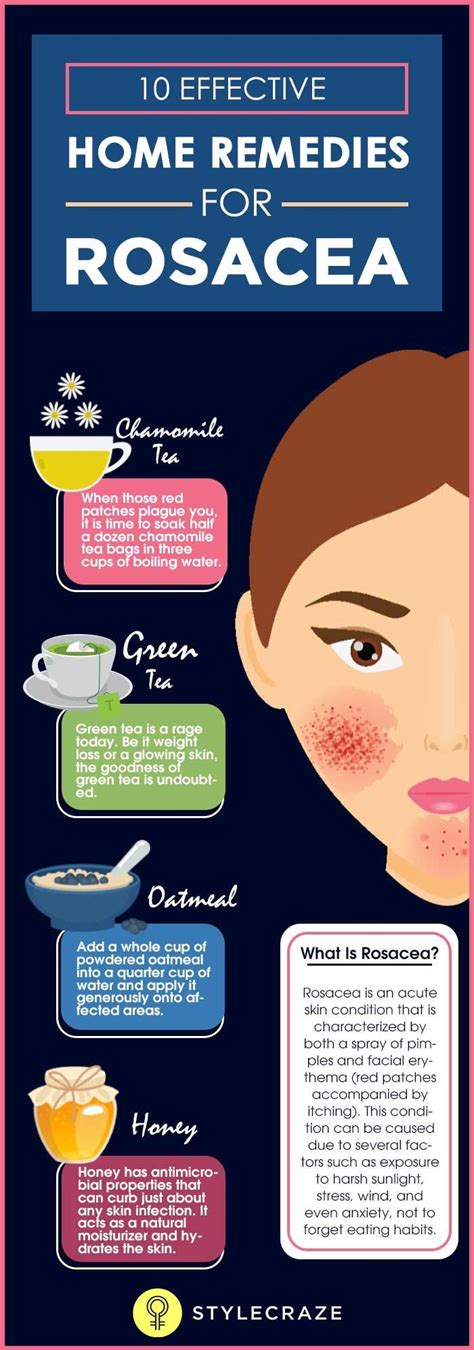 Home Remedies For Rosacea Artofit