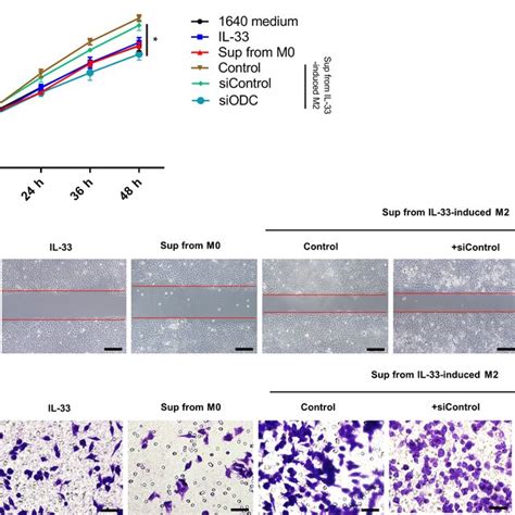 Supernatants From Il‐33induced M2 Macrophages Promote Escc Cells