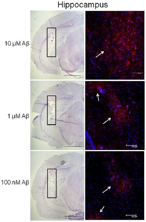 Immunohistochemical Analysis Showing Beta Amyloid Ab Content In