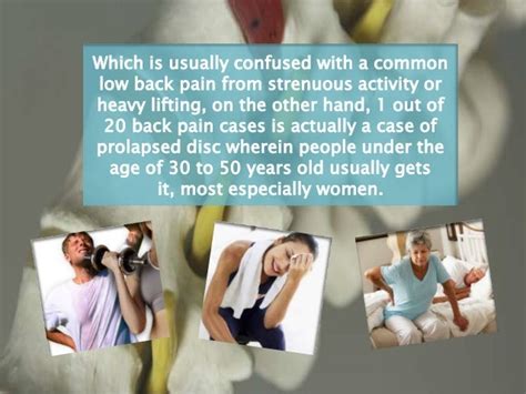 Cause Symptoms And Treatments For Prolapsed Disc