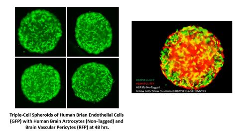 GFP Expressing Human Brain Microvascular Endothelial Cells Angio Proteomie