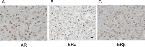 Immunohistochemical Staining For Ar A Er B And Er C In The