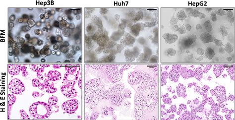 3d Organoid Modelling Of Hepatoblast Like And Mesenchymal Like Hepatocellular Carcinoma Cell Lines