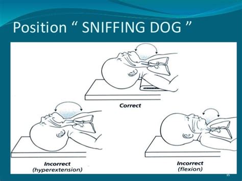 New Born Resuscitation Power Point Presentation