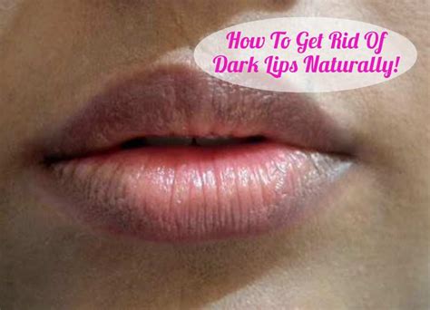 How To Rid Of Dark Lips Lipstutorial Org