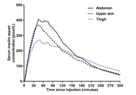 Bolus Insulin The Glucose Never Lies