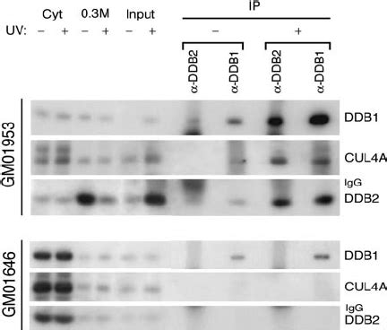 DDB1 CUL4A DDB2 E3 Fails To Bind To Chromatin After UV Irradiation Of