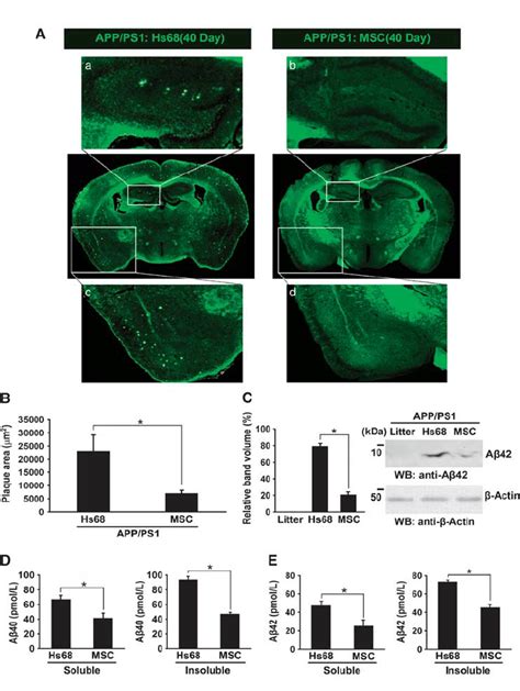 Transplantation Of Hucb Mscs Reduces A B Plaques In App Ps Mice A