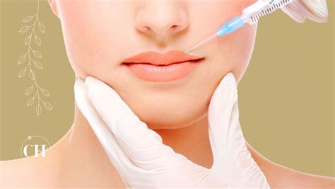 Preenchimento Labial Como é Feito Quanto Dura E Quais Cuidados Tomar