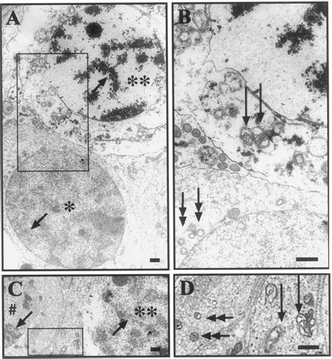 Electron Micrographs Of Cells From Human Seminiferous Tubules A A