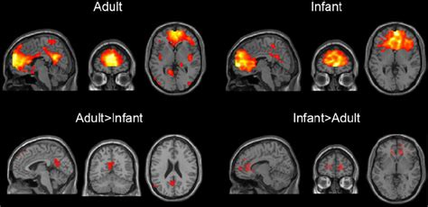 Default Mode Network In Adults And Infants Notes Each Triplet Shows Download Scientific