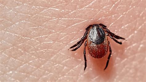 How Do You Remove A Tick Embedded In A Dog