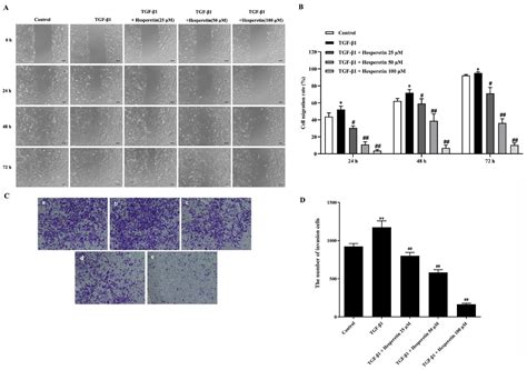 Hesperetin Inhibits TGF β1 Induced Migration and Invasion of Triple