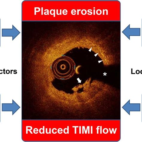 Representative Optical Coherence Tomography Images And Independent