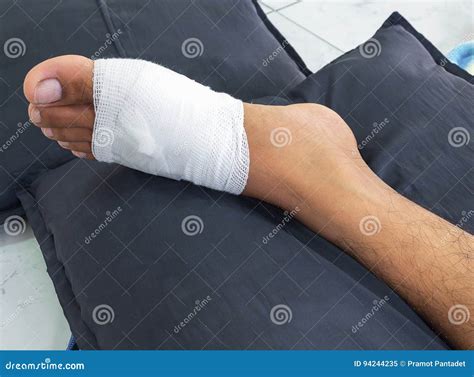 Gauze Bandage The Foot Treating Patients With Foot Ulcers Stock Image