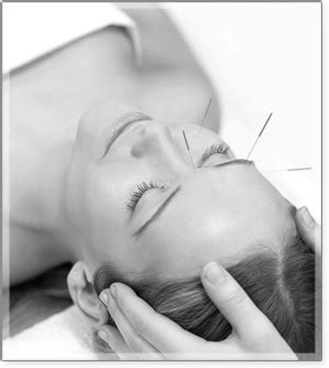 London Cosmetic Acupuncture