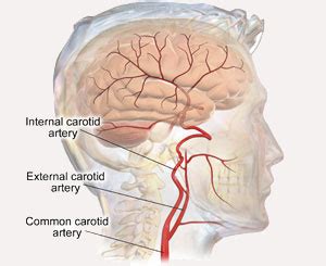 Tenet Florida Cardiovascular Care Dr Joseph Ricotta Md