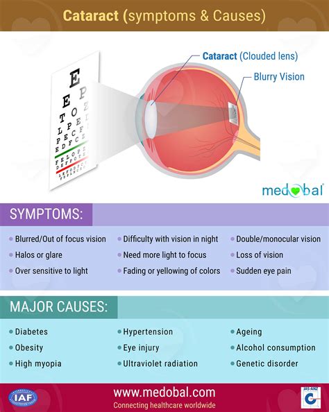 Cataract Symptoms And Causes Medobal Medium