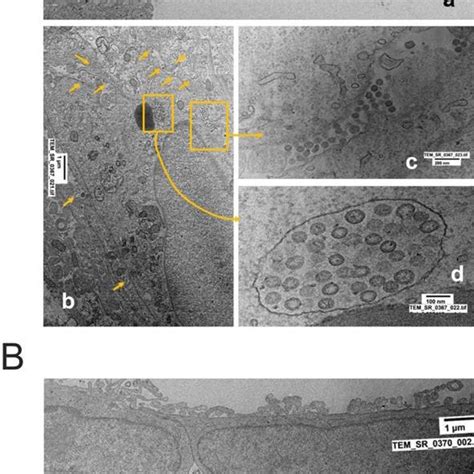 A A Control Vero E6 Cells B Sars Cov 2 Infected Vero E6 Cells Download Scientific