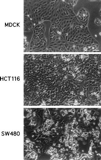 Morphology Of Mdck Hct116 And Sw480 Cells Cells Were Plated At 85