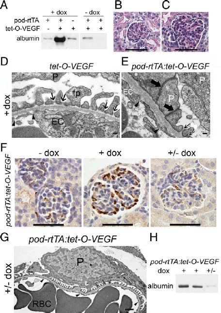 Podocyte Vegf 164 Overexpression After Birth Causes Mcd A Western