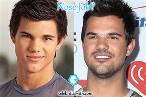 Taylor Lautner Nose Job, Plastic Surgery, Before-After Pictures ...