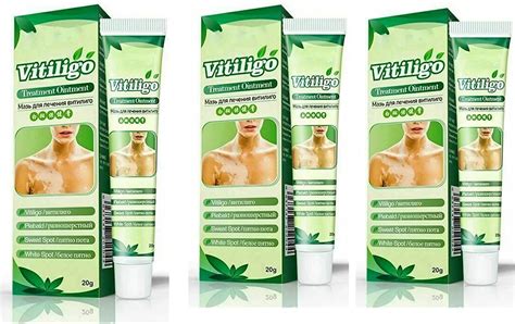 Buy White Tag Moisturizing Cream, Vitiligo , Leukoplakia - White Spots ...