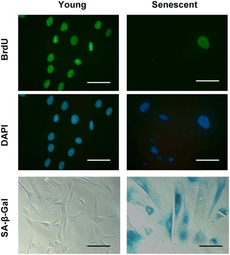 Characterization Of Senescent Human Skin Fibroblasts Early Passage