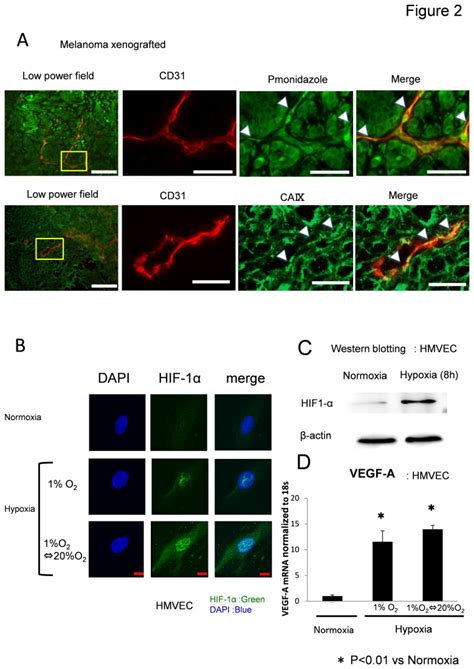 A The Hypoxic Area In Human Tumor Xenografts In Nude Mice Was