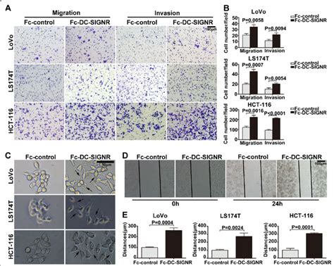 Dc Signr Promotes Colon Cancer Cell Migration And Invasion In Vitro A