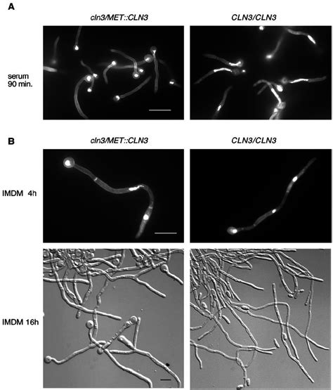 Repression Of Cln3 Under Hypha Inducing Conditions Delays Nuclear Download Scientific Diagram