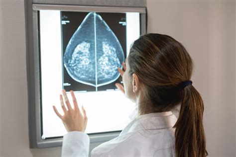 What You Need To Know Before Choosing A 2d Or 3d Mammogram